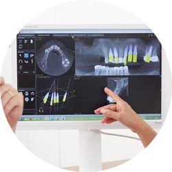 Keramikimplantat-Hamburg-Entzuendungsherde-start